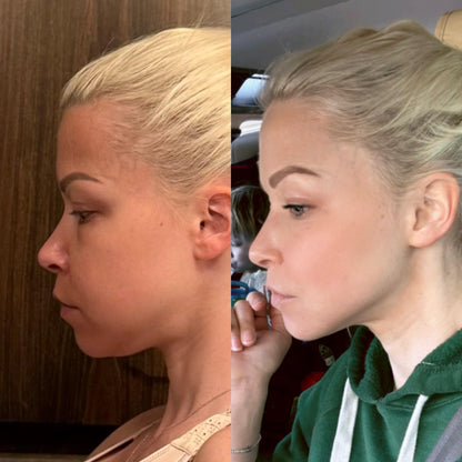 HaloSculpt Pro® — 4-in-1 Microcurrent + Red Light To Sculpt Your Jawline