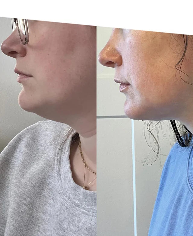 HaloSculpt Pro® — 4-in-1 Microcurrent + Red Light To Sculpt Your Jawline