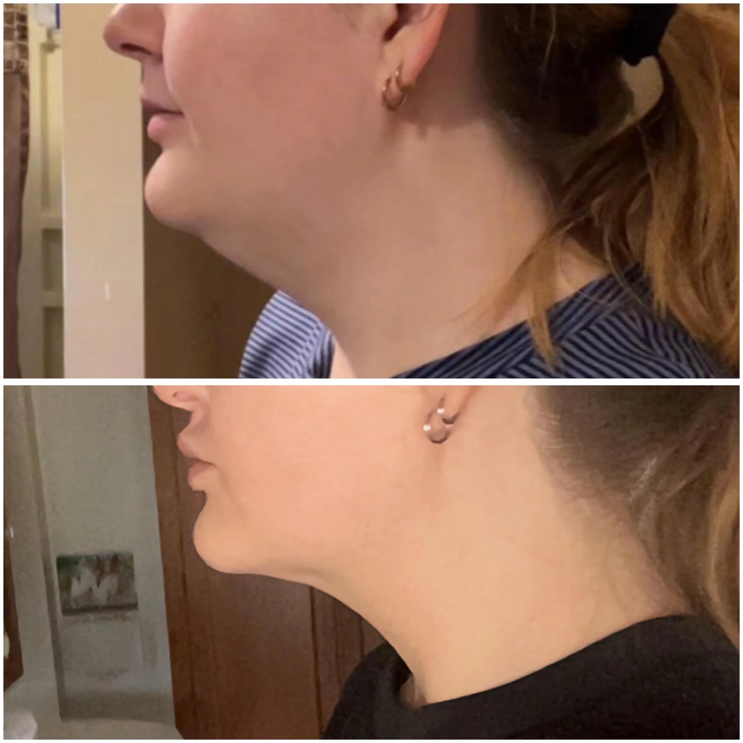 HaloSculpt Pro® — 4-in-1 Microcurrent + Red Light To Sculpt Your Jawline